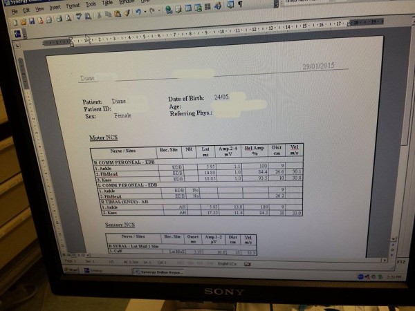 I stole a photo of my dismal EMG results.